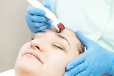 Kadın bir modern tıbbi alet derma roller ile tıbbi mikro iğne tedavisinin yordamı geçer