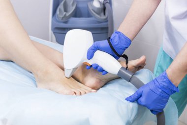 Kadın bacaklarda Güzellik Salonu lazer epilasyon işlemi