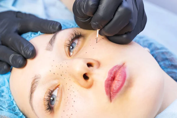 Permanent microblading tattooing freckles to a woman in a beauty salon