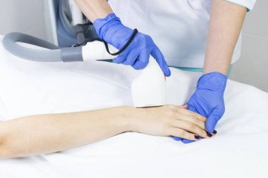 Kadın bacaklarda Güzellik Salonu lazer epilasyon işlemi.