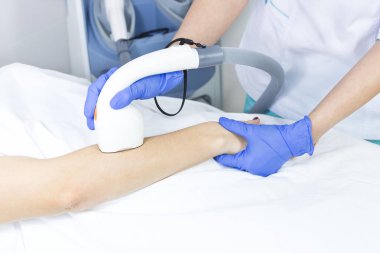 Kadın bacaklarda Güzellik Salonu lazer epilasyon işlemi.