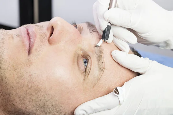 Mannelijke Microblading Procedure Ter Verbetering Van Conditie Van Een Man — Stockfoto