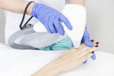 Kadın bacaklarda Güzellik Salonu lazer epilasyon işlemi.