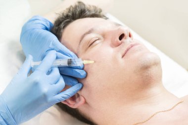 Adam yüz derisinin durumunu iyileştirmek için klinikte mezoterapi görmüş..