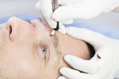 Bir adamın kaşlarını güzellik salonunda iyileştirmek için genç bir adamın mikropatinaj prosedürü..