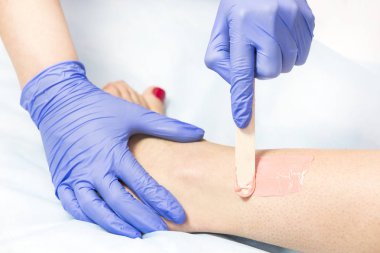 Kadın bacaklarda Güzellik Salonu lazer epilasyon işlemi. 