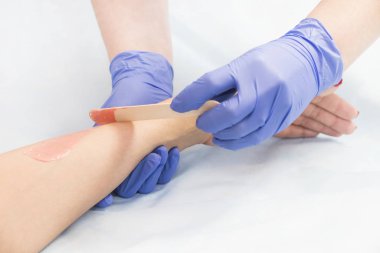 Kadın bacaklarda Güzellik Salonu lazer epilasyon işlemi. 