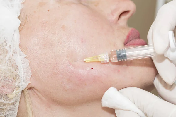 Procédure Injection Cosmétique Dans Salon Beauté Face Une Femme Âge — Photo