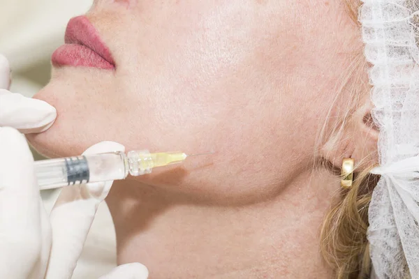 Procedimiento Inyección Cosmética Salón Belleza Frente Una Mujer Mediana Edad — Foto de Stock