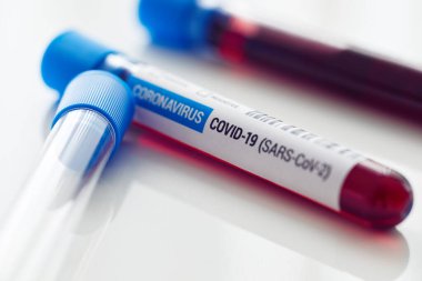 Masadaki Coronavirus 'a kan örnekleri taşıyan ampuller, Covid-19 testi..