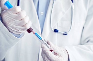 Kan örneği ve şırıngayla erkek doktor. Coronavirus testi, Covid-19.