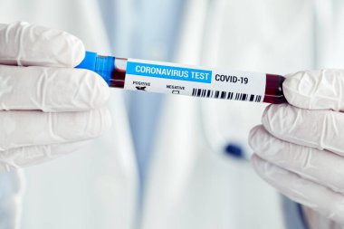 Coronavirus hastalığı için pozitif kan örneği olan erkek doktor, Covid-19.