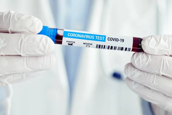 Médico Varón Con Muestra Sangre Positiva Para Enfermedad Coronavirus Covid —  Fotos de Stock