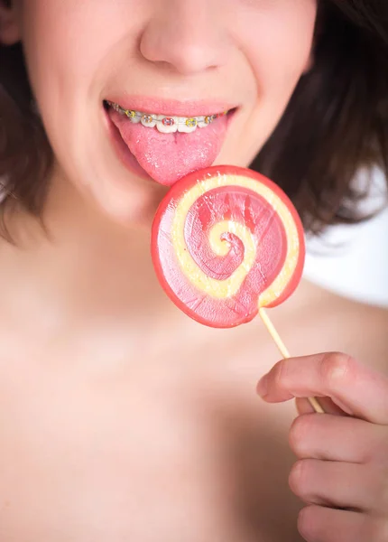 Close-up shot of girl with multicolored bracket systems and lollipop — Stock Photo, Image