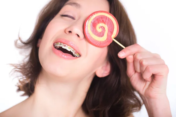 Close-up shot of girl with multicolored bracket systems and lollipop — Stock Photo, Image