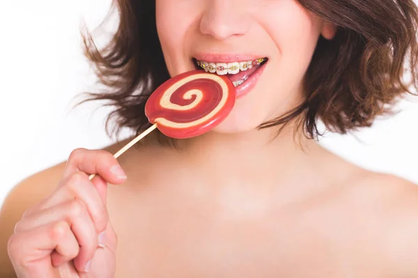 Close-up shot of girl with multicolored bracket systems and lollipop — Stock Photo, Image