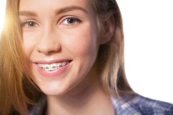 Hermosa Joven Rubia Mostrando Sus Frenos Dentales Aislados Blanco — Foto de Stock