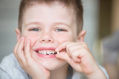 Dişi dökülen genç bir çocuk.