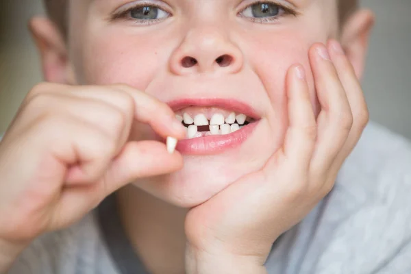 Дитина-підліток з зубом випав — стокове фото