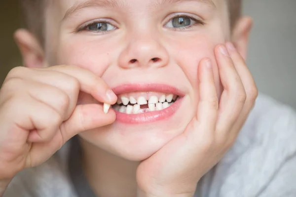 Criança adolescente com um dente retirado — Fotografia de Stock