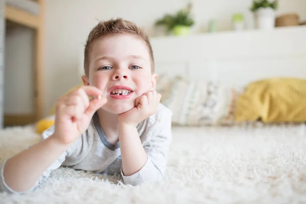 Adolescente niño con un diente caído —  Fotos de Stock