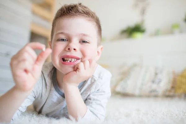 Adolescente niño con un diente caído — Foto de Stock