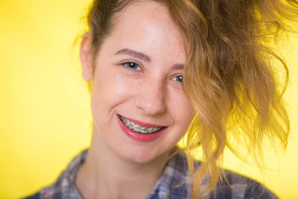 Jong Meisje Een Geruit Shirt Tonen Haar Gebit Beugel — Stockfoto