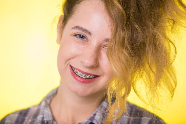 Mladá Dívka Kostkované Košili Ukazující Její Zubní Rovnátka — Stock fotografie