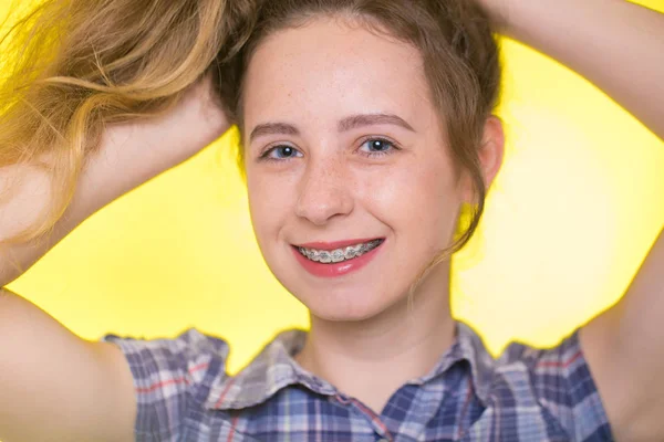 Chica Joven Con Una Camisa Cuadros Mostrando Sus Frenos Dentales —  Fotos de Stock