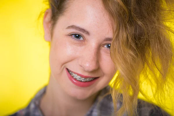 Młoda Dziewczyna Koszuli Kratę Pokazuje Aparat Dentystyczny — Zdjęcie stockowe