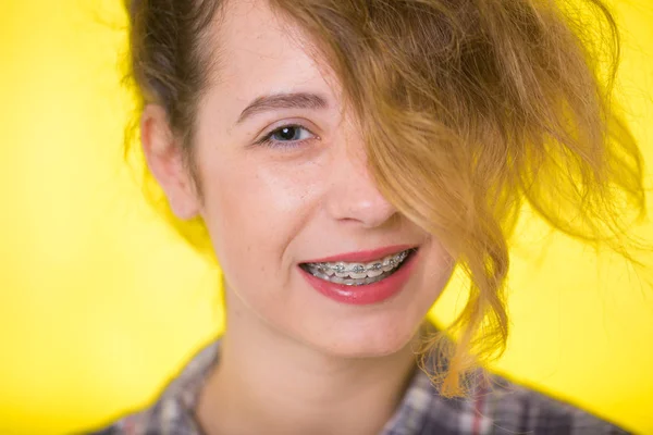 Menina Jovem Uma Camisa Xadrez Mostrando Seus Aparelhos Dentários — Fotografia de Stock