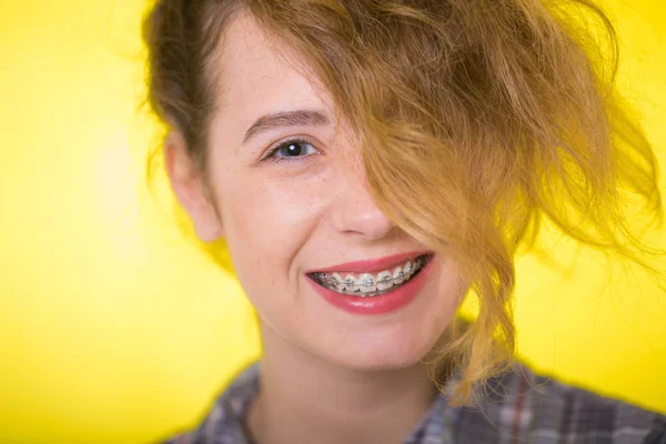 Jong Meisje Een Geruit Shirt Tonen Haar Gebit Beugel — Stockfoto