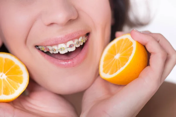 Closeup Young Woman Face Lemon Fruit Wearing Teeth Braces — Photo