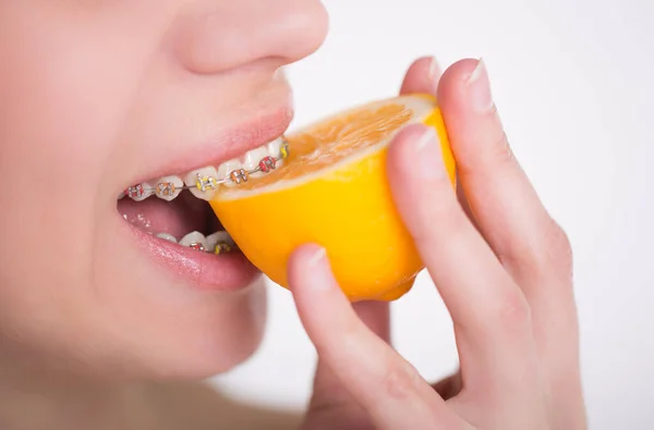 Zbliżenie Młoda Kobieta Twarz Owoców Cytryny Noszenie Aparatów Zęby Obrazy Stockowe bez tantiem