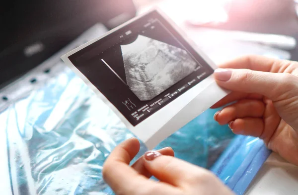 Pregnancy. Ultrasound screening scan in a woman hands.