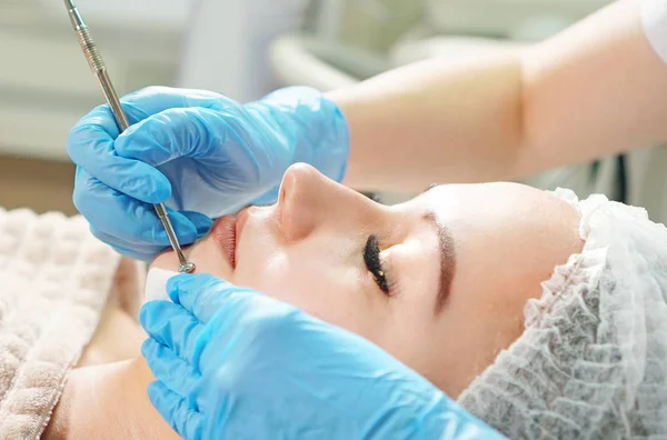 Cosmetologist doing mechanical face peeling treatment for the patient face, close up