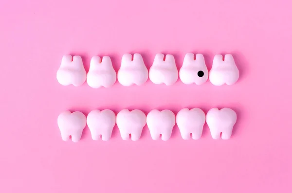 Tło Stomatologiczne Modelami Zębów Dwóch Liniach Jeden Ząb Próchnicą — Zdjęcie stockowe