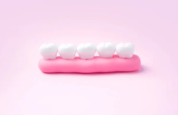 Dental concept. Toy gum with teeth made with plasticine.