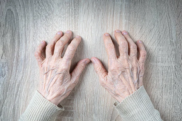 Las manos de una anciana sobre la mesa. Manos arrugadas con venas — Foto de Stock