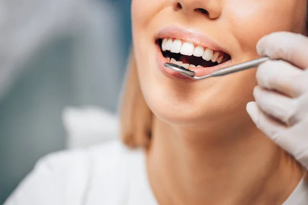 Denti e concetto di igiene. Giovane donna dal dentista — Foto Stock