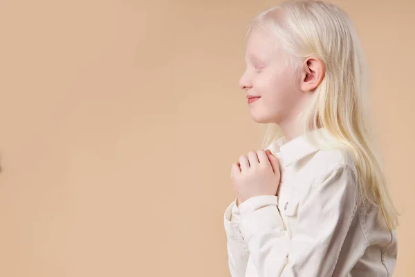 Albino. Menina bonito com síndrome de albinismo — Fotografia de Stock