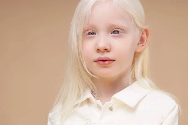 Albino menina com pele branca e cabelo branco isolado — Fotografia de Stock