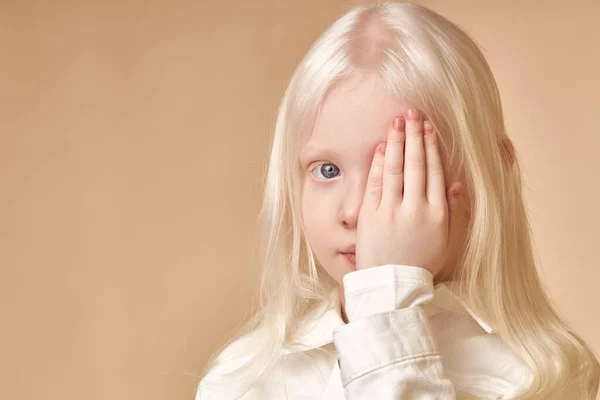Albínó. Aranyos kislány albínó szindrómával. — Stock Fotó