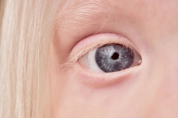 Foto mística de primer plano del ojo infantil albino — Foto de Stock