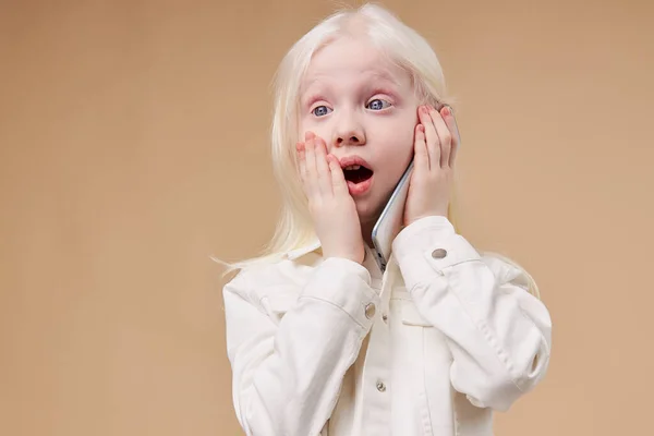 Surpresa albino criança com telefone — Fotografia de Stock