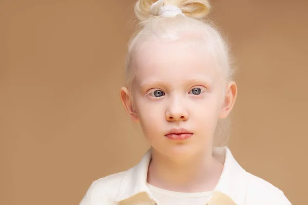 Albino menina com pele branca e cabelo branco isolado — Fotografia de Stock