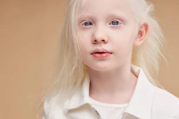 Impresionante niño albino con cabello rubio, aislado —  Fotos de Stock