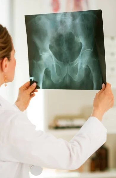 Ärztin Beim Blick Auf Die Fluorografie Rückansicht — Stockfoto