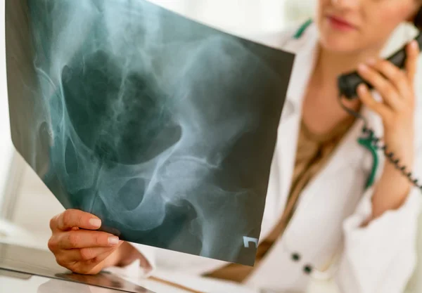 Closeup Medical Doctor Woman Looking Fluorography Talking Phone — Stock Photo, Image