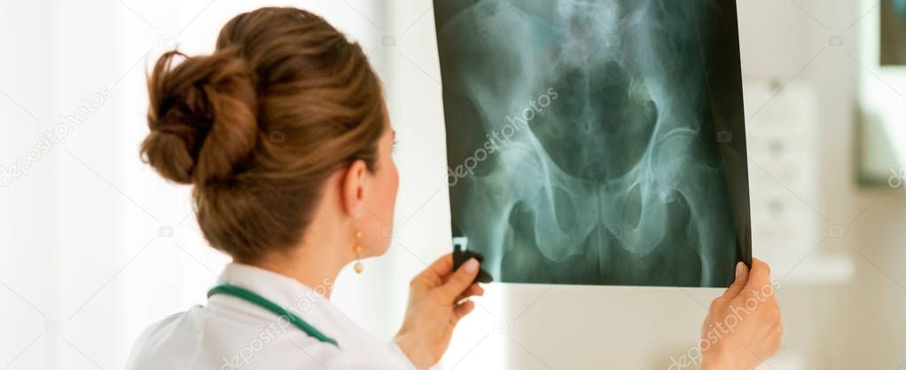 Doctor woman looking on fluorography. rear view